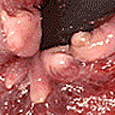 <font size=2px>심한 내치질</font>